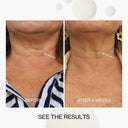 Neck & Décolletage Lifting Concentrate