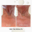 Neck & Décolletage Lifting Concentrate