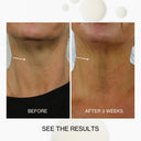 Neck & Décolletage Lifting Concentrate