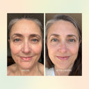Jojoba Boost Skin Renewal