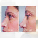 Transformative Eye Serum