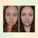 Jojoba Boost Skin Renewal