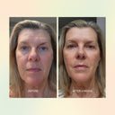 Jojoba Boost Skin Barrier Support
