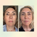 Jojoba Boost Skin Barrier Support