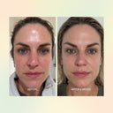 Jojoba Boost Skin Renewal